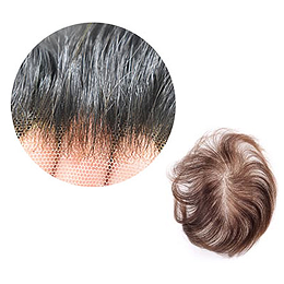 hair-density-img