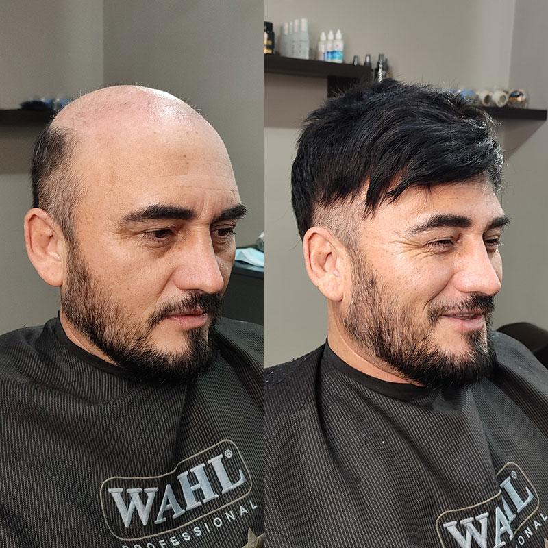 Hair System Before After Image