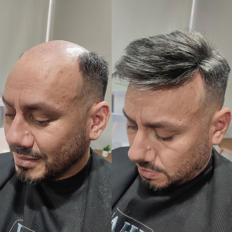 Hair System Before After Image