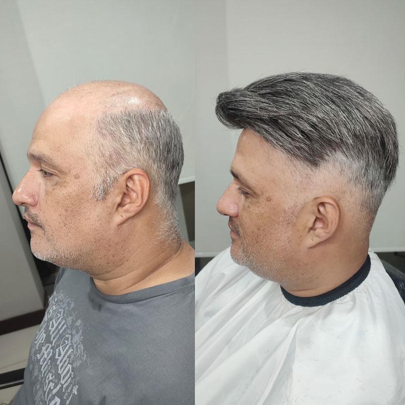 Hair System Before After Image