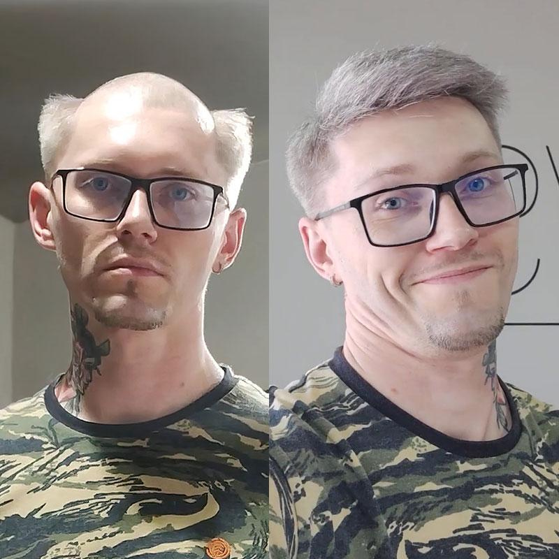 Hair System Before After Image