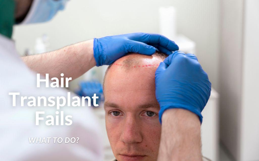 Blog image thumbnail