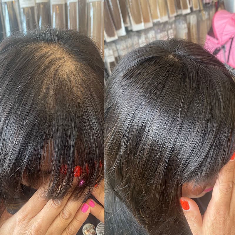 After-Before