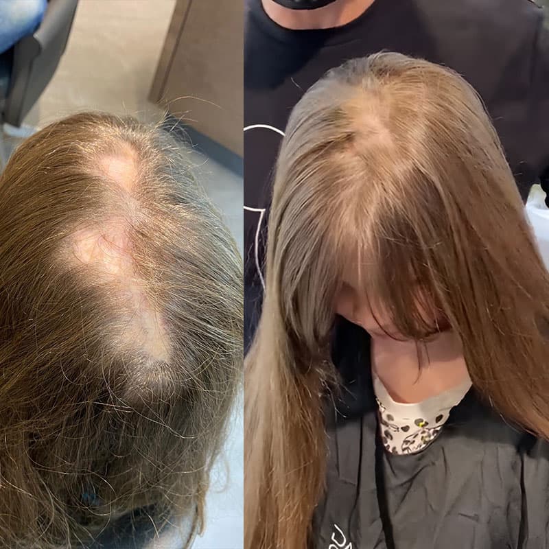 After-Before