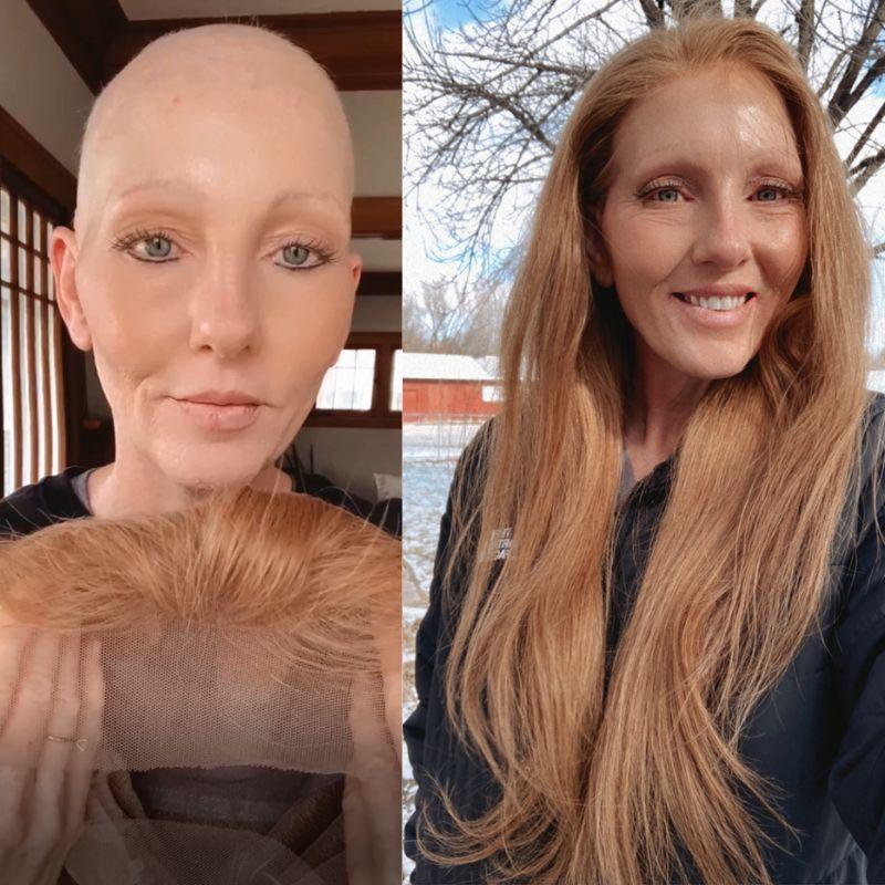 Hair System Before After Image