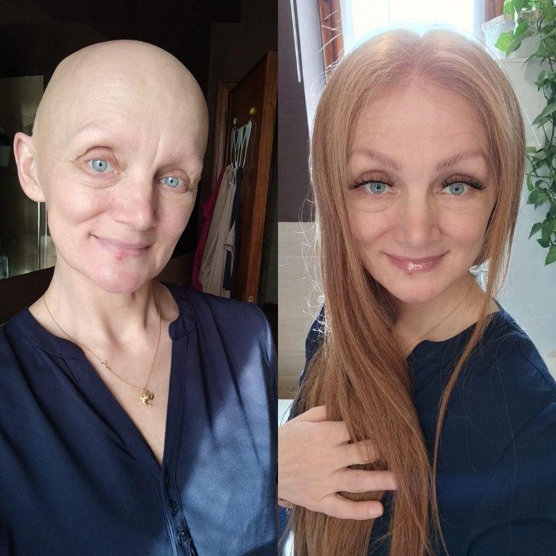 Hair System Before After Image