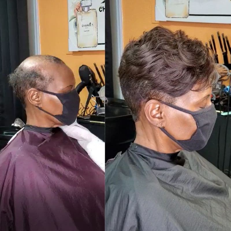 After-Before