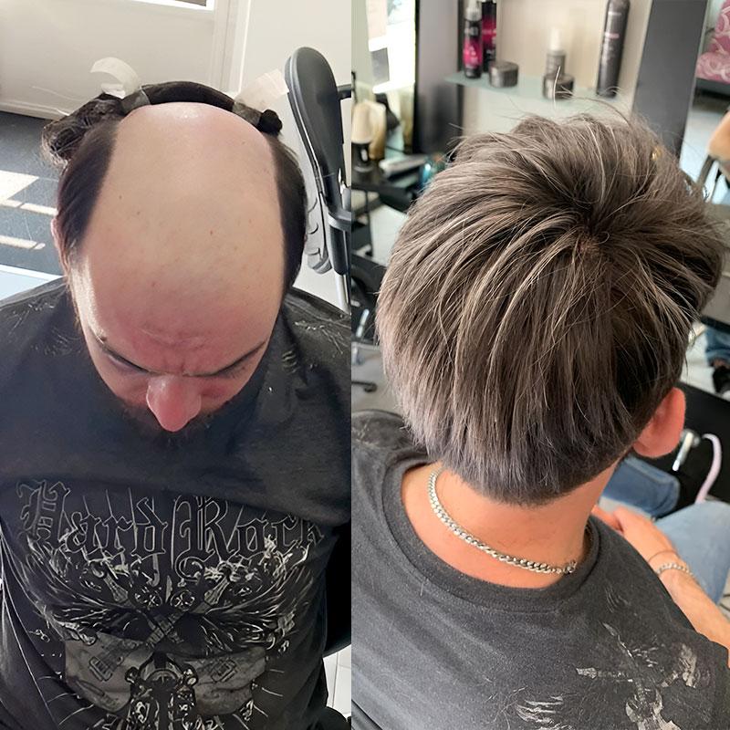 Hair System Before After Image