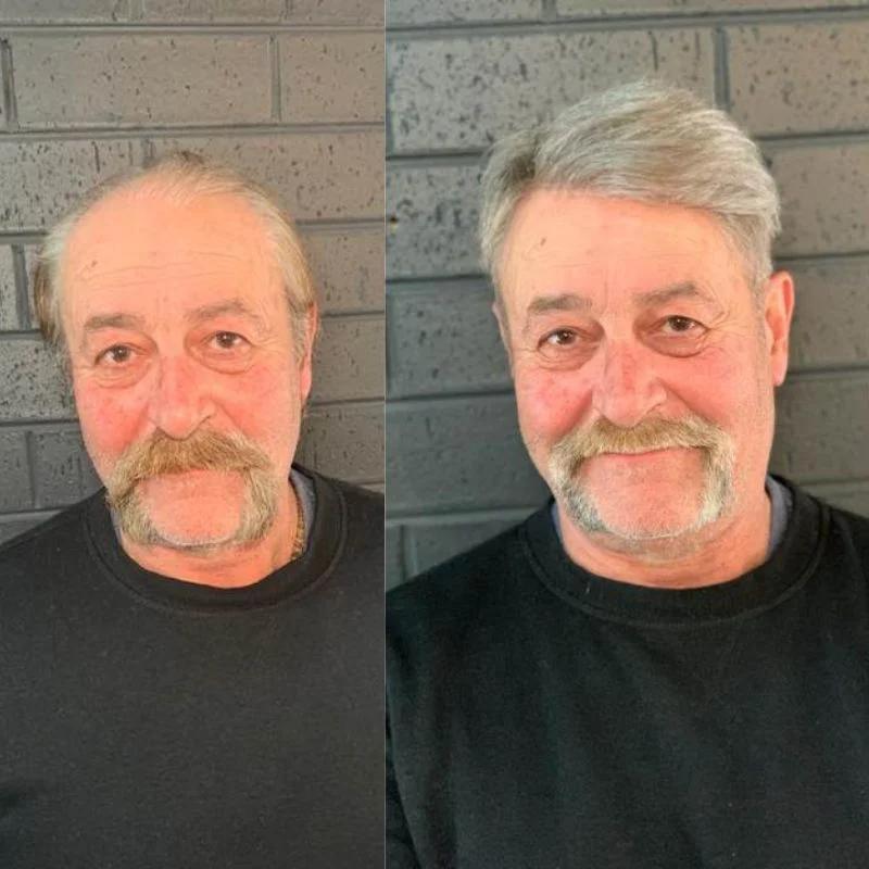 Hair System Before After Image