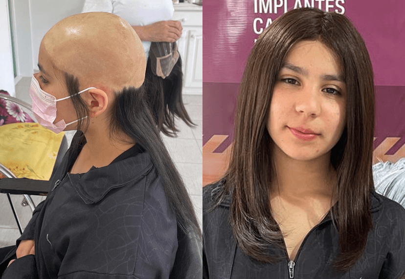 Free Wig Programs