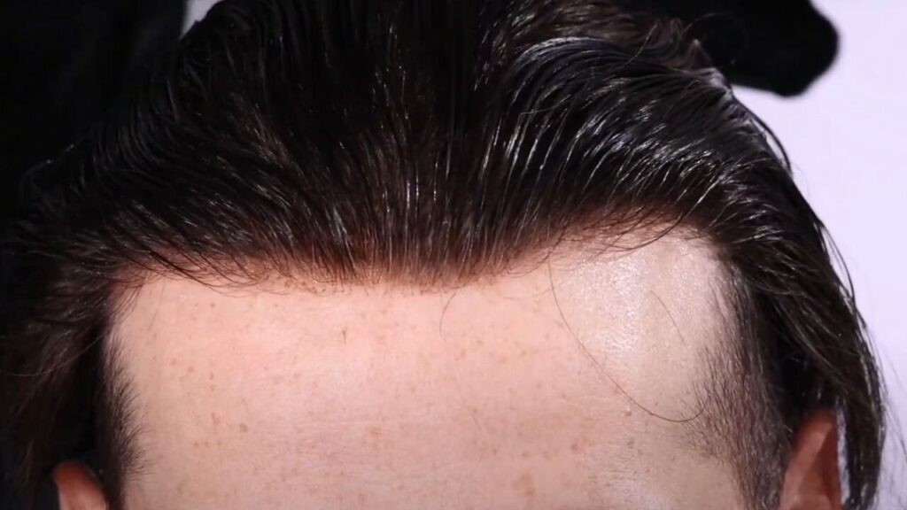 A man's wearing a toupee with perfect looking hairline